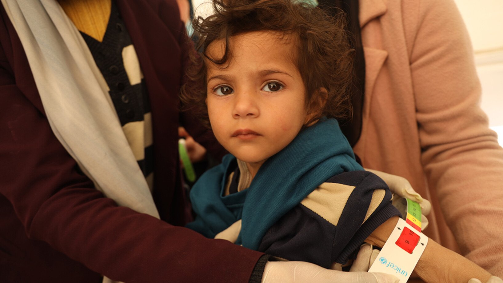 Ein Junge wird in Gaza auf Mangelernährung untersucht.