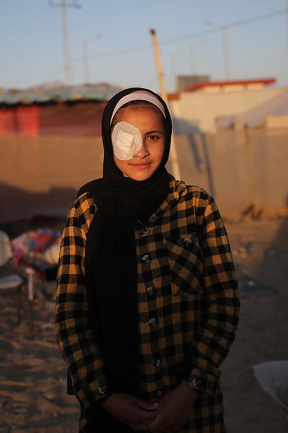 Die 15-jährige Abrar verlor bei dem Angriff auf ihr Haus im Gazastreifen ihr rechtes Auge.