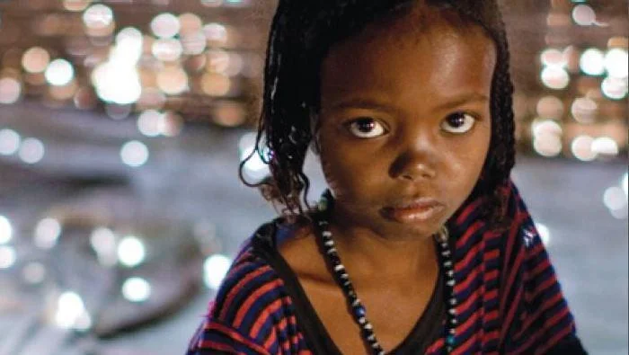 FGM