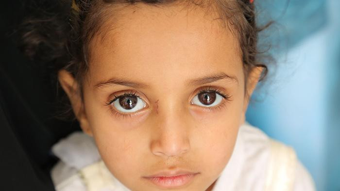 Child in Yemen 2018