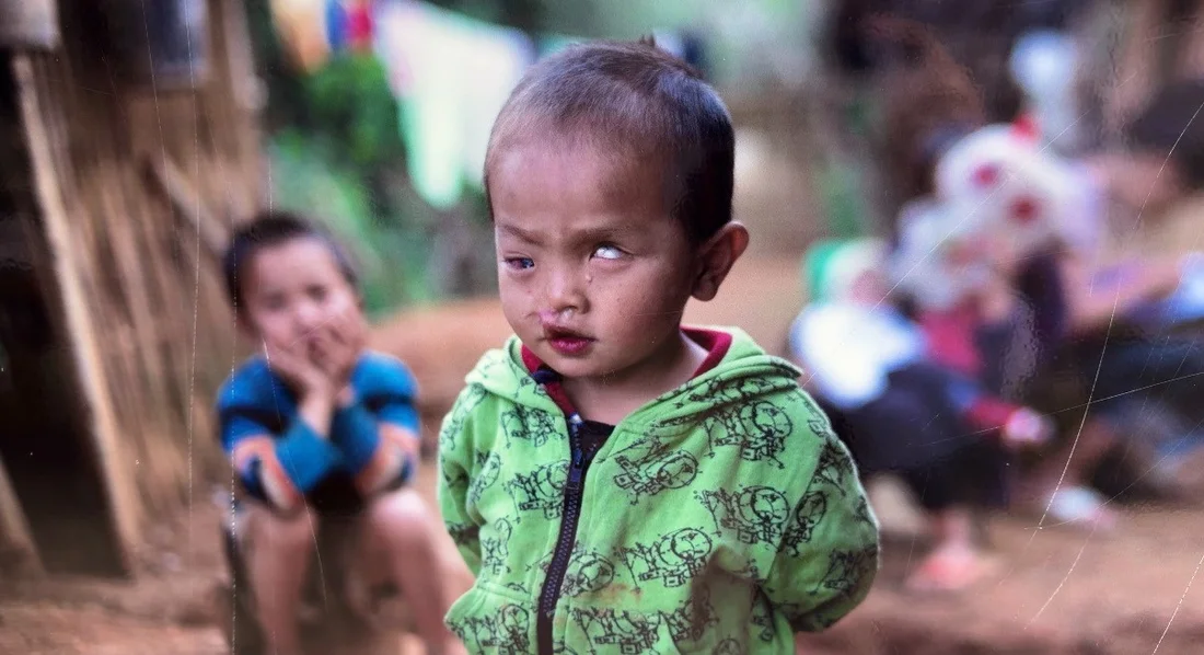 Laos, UXO, Kayeng nach dem schweren Unfall