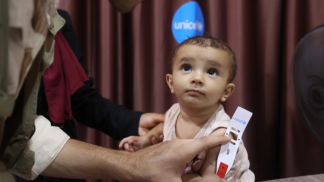 Mädchen in Gaza wird auf Mangelernährung untersucht