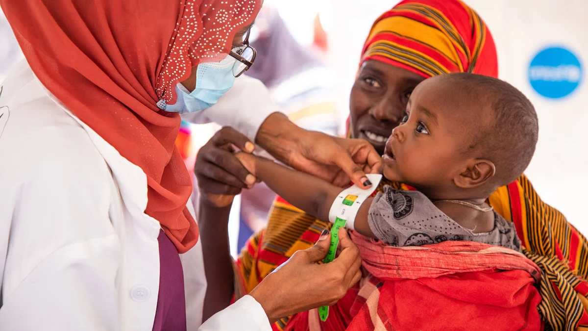 Ein kleines Kind in Somalia wird untersucht.