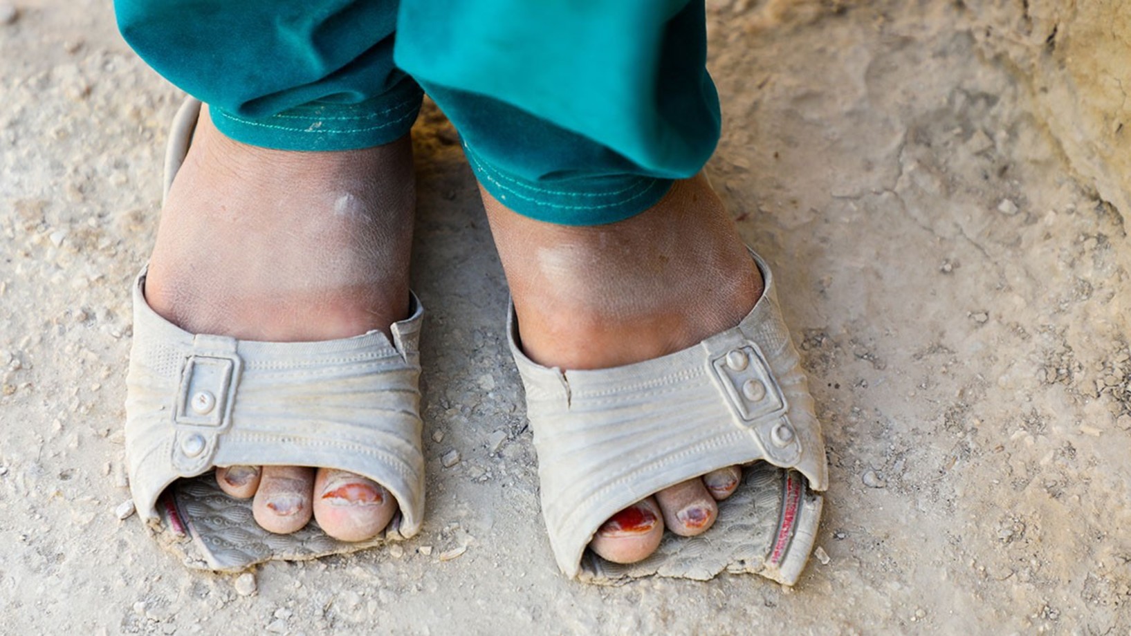 Kaputte Schuhe, Afghanistan 2020