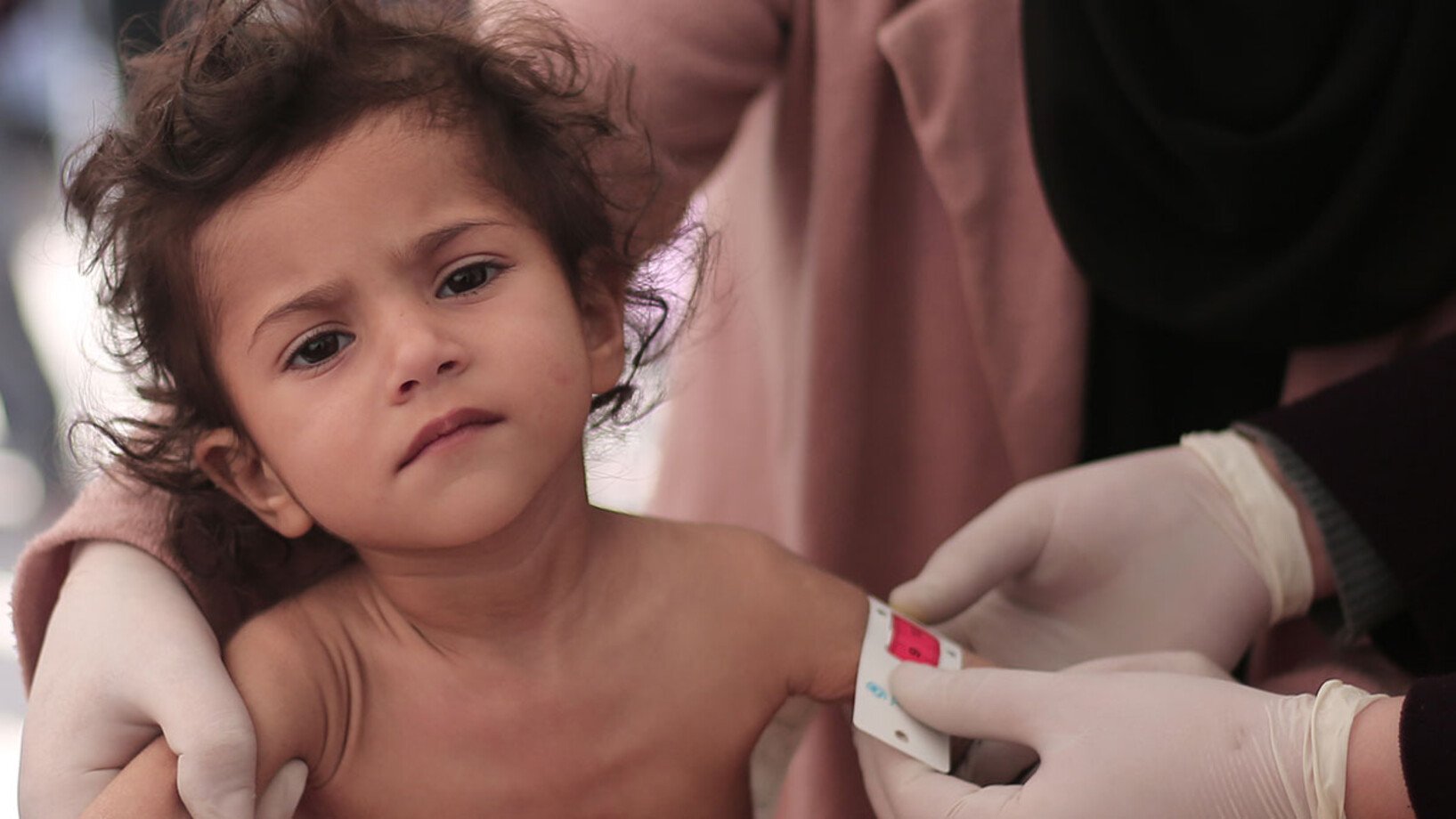Mädchen Unterernährung Gaza