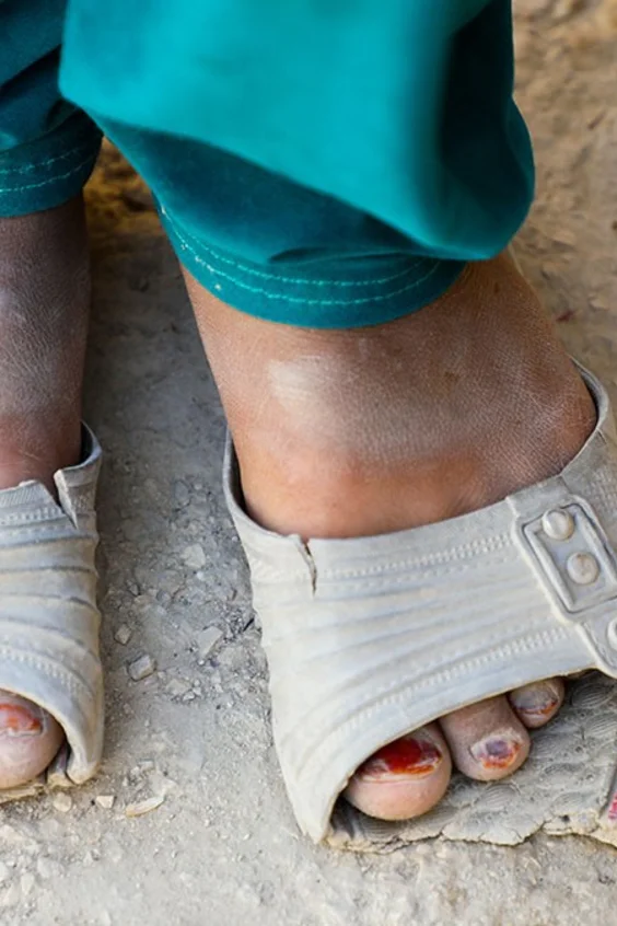 Kaputte Schuhe, Afghanistan 2020