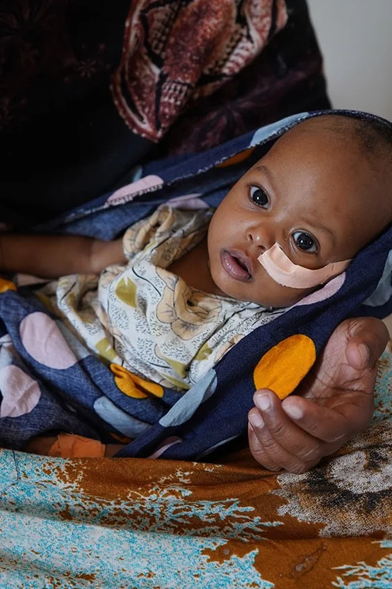 © UNICEF/UN0663263/Sewunet