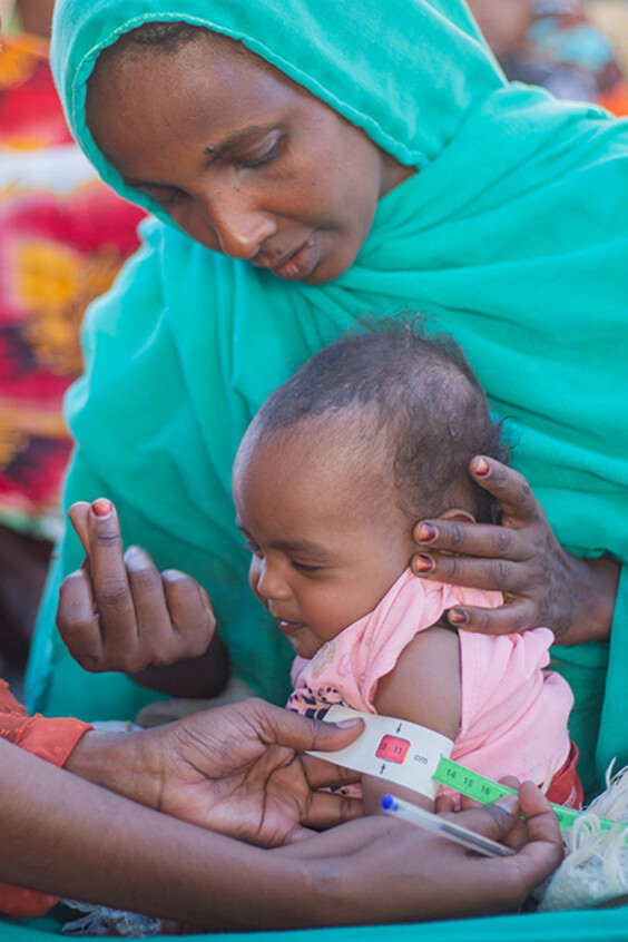 Zwei Frauen messen den Arm einer Zweijährigen und kontrollieren sie auf Mangelernährung.