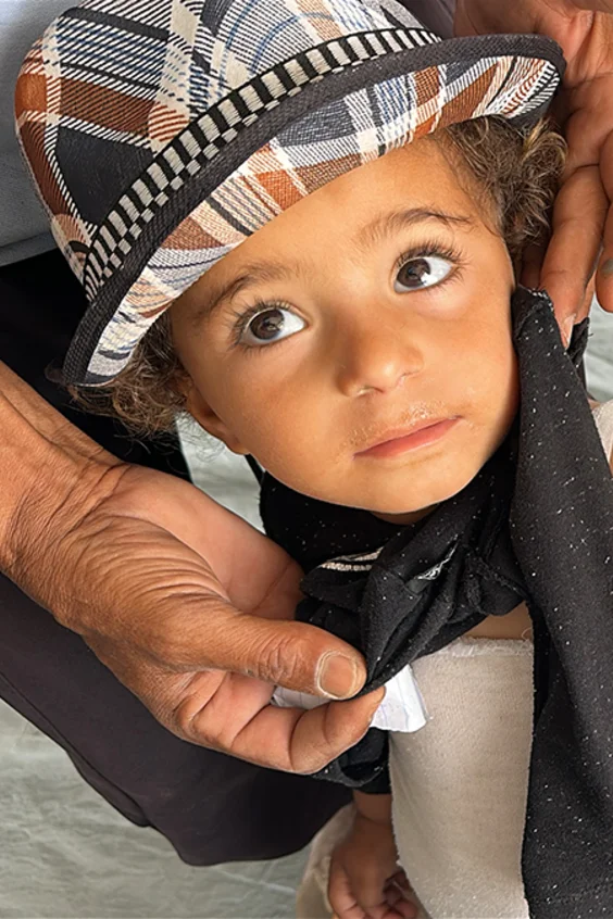 Ein kleiner Junge wird in Gaza auf Mangelernährung untersucht. Dabei wird sein oberer Armumfang abgemessen.