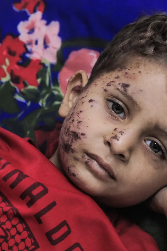 Hilfe für Kinder in Gaza